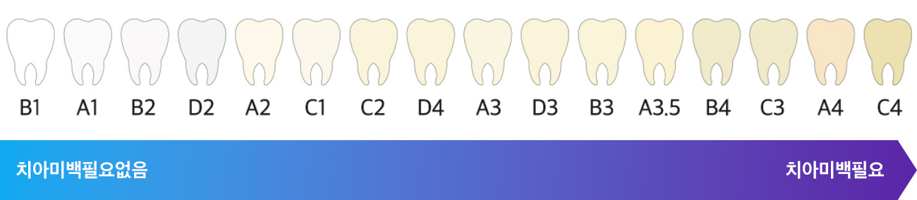 치아색상 자가진단법
